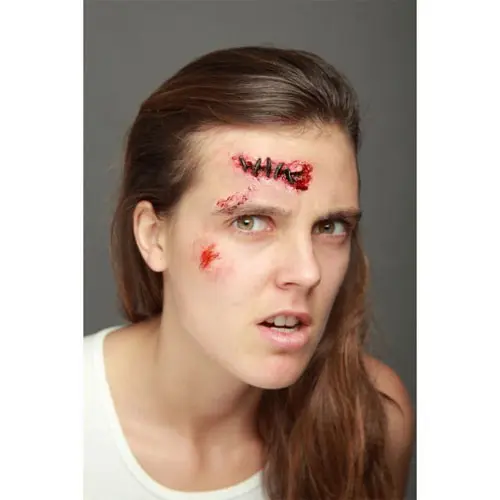 Wond applicatie - Stitches